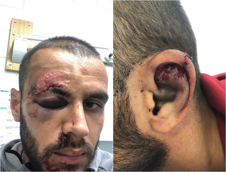 SUKOB ZBOG PARKINGA Rođak bivšeg Slavenaša oslobođen za premlaćivanje Koprivničanca