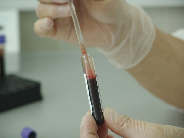 Najavljen novi test za rano otkrivanje raka debelog crijeva